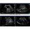 High Resolution Ultrasonic Diagnostic System Portable 3D/4D Color Doppler Ultrasound Scanner Machine