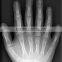 medical dry film agfa mqct-178/14x17in blue dry x ray film with high quality and cheap price/blue x ray medical film