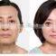 Bipolar RF radio frequency slimming & skin treatment beauty equipment