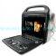 Premium 4D Color Doppler Ultrasound Scanner