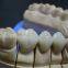 Dental Laboratory Full Ceramic Zirconia Crown Manufacturer in China