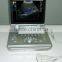 3D 4D Portable Color Doppler Ultrasound System