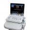 MY-A024J medical appliance mobile ultrasonic color doppler china portable ultrasound machine with probe
