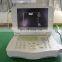 MY-A004 Hospital Sonar Ultrasound Equipment Portable Ultrasound Machine