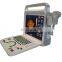 Good quality 15 inch LED full digital  Portable  color doppler ultrasound scanner