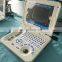 HC-A006 Black /white Laptop Ultrasound Scanner Linear Probe for Clinic Hospital Lab