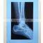Dry film x-ray film blue medical film china film