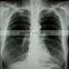 thermal film china film medical equipment medical x-ray kodak film hot film