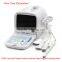 Promotion!!CE approved Portable Ultrasound Scanner with 3.5Mhz multi-frequency convex probe RUS-9000A