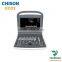 medical User-friendly 2d portable black and white ultrasound CHISON ECO2