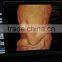 MC-DU-06 Portable Color Doppler Ultrasound Scanner