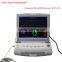 Factory price!!! 2016 CE approved Portable Digital Color Fetal Monitor RFM-300C