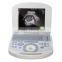 portable ultrasound scanner ultrasound machine with low price