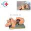 HC-S032 Advanced Airway Management Model,Tracheal Intubation Training Model Mannequinwith Alarm