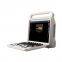 C20 Color Ultrasound machine, Color Doppler