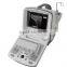 MCB-9300 Black and White Ultrasound Machine