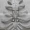 Spine Implants Medical Nitinol Sheet shape memory alloy sheet