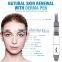 manufacturer customer service adjustable 5 level speed dermapen for sale