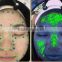 Magic mirror 3d facial skin acne analyzer/ skin moisture analysis equipment