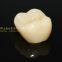 Dental crown solid zirconia bruxzir, dental teeth, laboratoire dentaire, Dentallabor, laboratorio dental, dental laboratory, Shenzhen LJ dental lab China