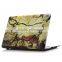 Artist Hard Plastic Case Cover for Macbook Laptop Quality Choice