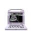 Laptop vet ultrasound scanner devices for various animal test use 3018vp