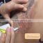 Newest Medical Q Switch Nd yag Laser Tattoo Removal Equipment/machine