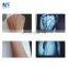 Table top/Portable medical infrared vein viewer finder machine for finger Vascular detector illuminator