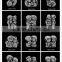 Ready Stock 12 Styles Love Emotion Stainless Steel European Charms Spacer Beads For Charm Bracelet Necklace Making SEB-LG153
