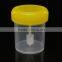 Medical Dispose 60 ML Stool Container