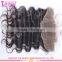 China Alibaba Gold Human Hair Supplier Frontal Lace Closure