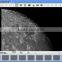 TVV3000-450F95 3.0MP USB digital refractive telescope