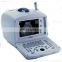 DP -2200 Veterinary ultrasound digital portable ultrasound