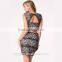 New Women Summer Casual Floral Sleeveless Sexy Party black lace dress, black lace dress, dress woman 2015