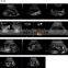 FM-480 Hot Sale 4D Color Doppler for medical