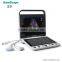 SonoScape S9 color doppler 4d ultrasound machine