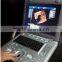 Portable Ultrasound Machine CU18A Made by Latest Color Ultrasoun Technology