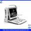 Portable Ultrasound Scanner Price