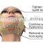 Sincoheren HIFU Non-invasive effective Wrinkle removable and facelifting