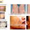 Skin Whitening POPIPL Brand Multi-Functional Beauty Equipment POP-E9 Medical