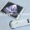Working on Iphone Ipad Android phone/pad Medical Ultrasonic Scan Equipment Portable Wireless Ultrasound Probe