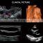 Latest Version Sonoscape P15 Trolley Color Ultrasound machine /cw color doppler ultrasound Sonoscape P15