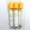 SST blood tube with gel and clot activator, yellow cap, CE and ISO 13485 certificates