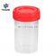 Laboratory 30ml 40ml 60ml Plastic Stool Sample Test Collection Container with Spoon