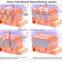 10600nm Professional CO2 Fractional Laser Machine Spot Medical Scar Pigment Removal For The Face Remove Neoplasms