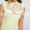 New Sleeveless High Neck Evening Party Dresses Fashion Knee Length Pencil Women Bodycon Lace Mesh Bandage Dress