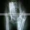 HOT selling thermal dry medical x-ray film /medical x-ray film agfa with CE hot film asia blue