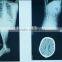 Agfa fuji film new product hospital can use medical digital film classsical film
