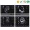 Cheap medical portable color doppler ultrasound elastography ultrasound gel prices