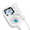 baby Heart Rate Monitor For Pregnant Women LCD display Portable Fetal Doppler